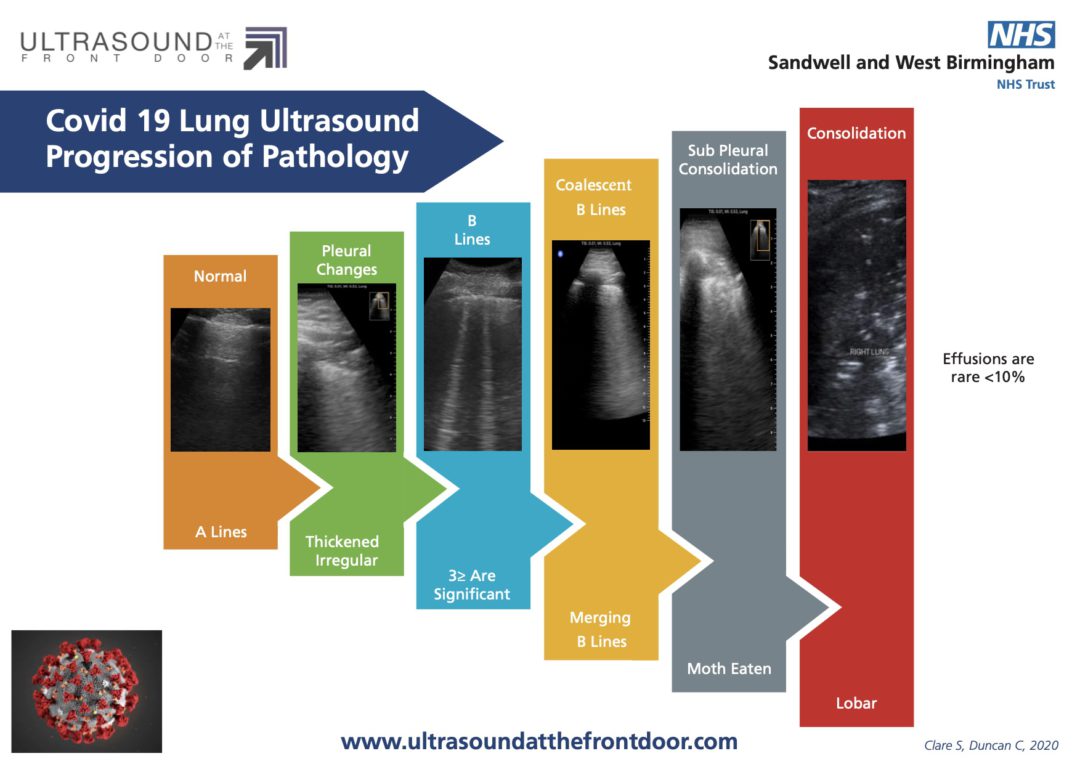 RCEM Core (Level 1) Ultrasound Ultrasound for the Generalist